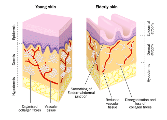 Aging of the skin